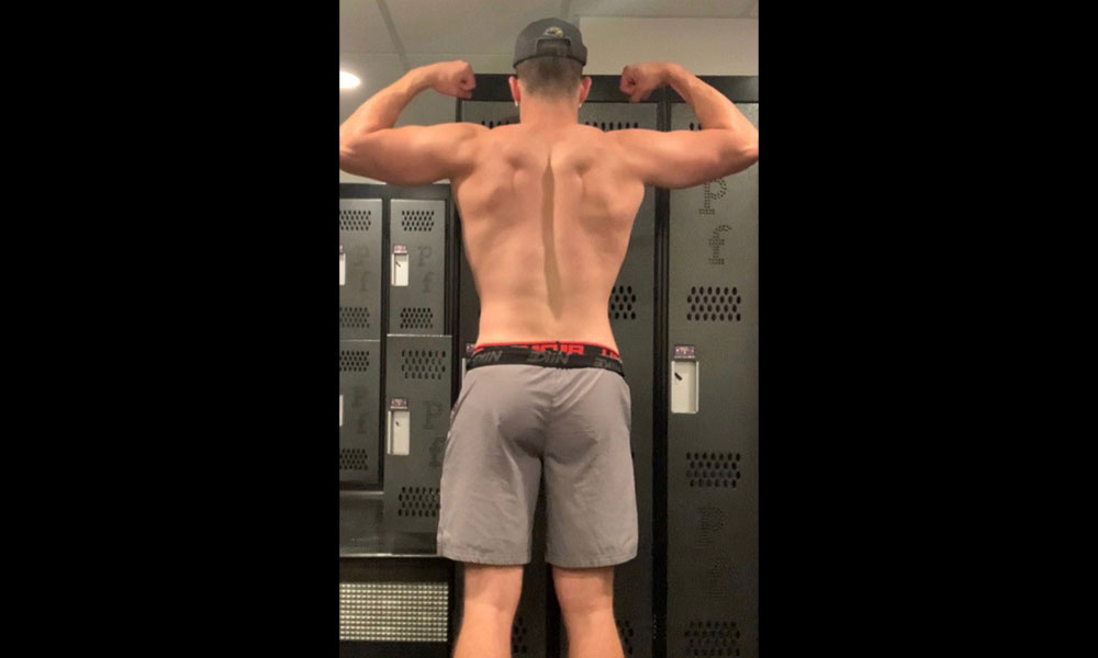 Before Transformation 4